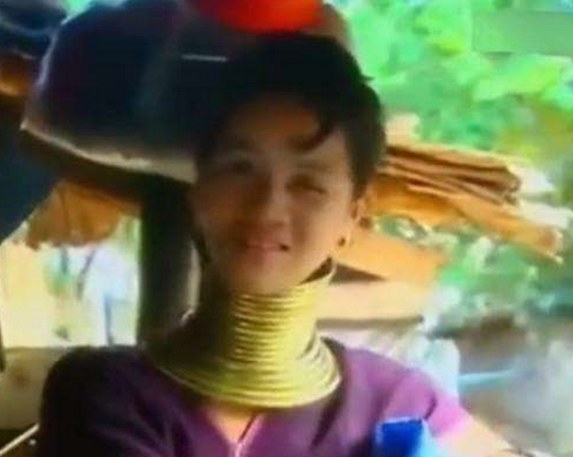 “长颈族”的妹子取下项圈后 脖子居然变成了这样!